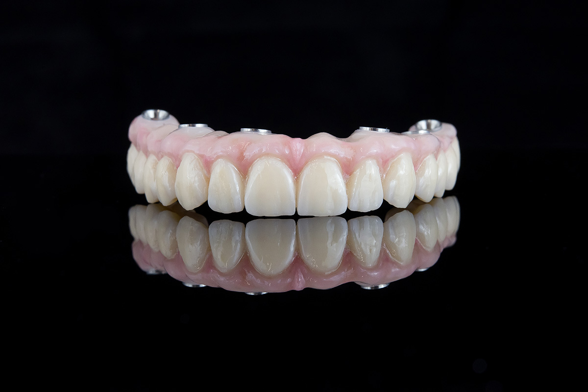 protese-dentaria